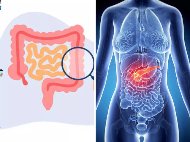 Increased Risk For Gastrointestinal Cancers