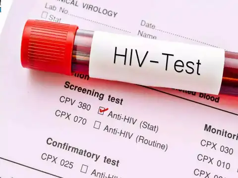 States Wise Distribution Of HIV Cases