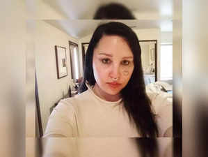Amanda Bynes discloses she had cosmetic surgery on her eyelids
