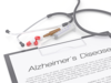 Research highlights overall brain health as key predictor of Alzheimer's risk