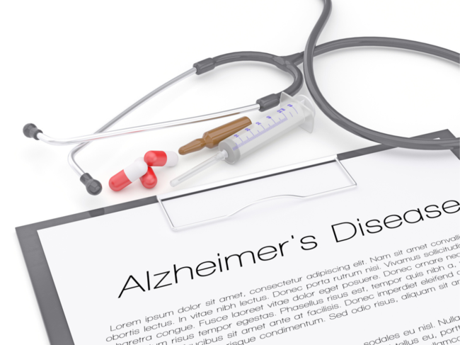 ​A recent study challenges conventional predictors of Alzheimer's disease​. (Representative Image)