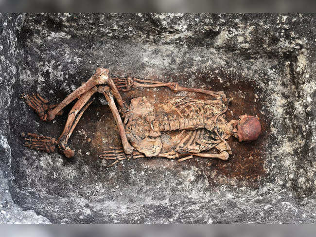 Ancient Skeletons Give Clues to Modern Medical Mysteries