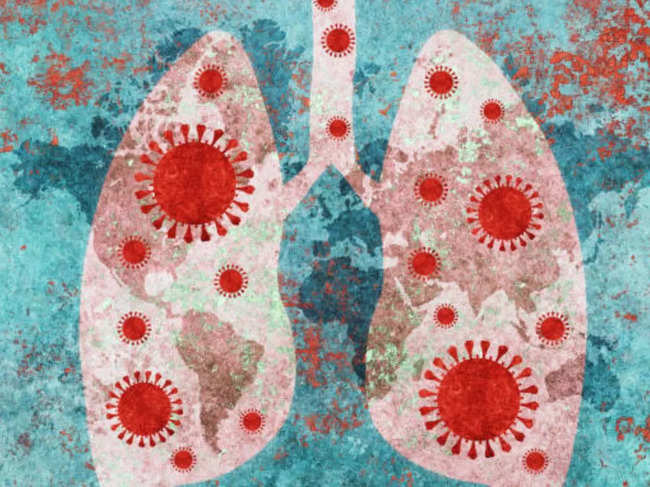 Study finds high rate of lung damage in Indians after acute Covid, experts decode why
