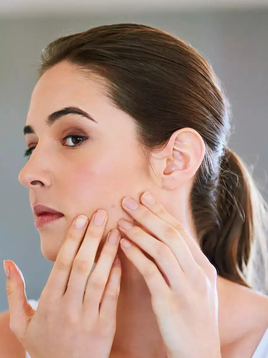 best-natural-ways-to-fight-pimples-economictimes