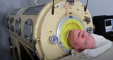 Paul Alexander, 'Polio Paul,' dies at 78 after spending 70 years in iron lung