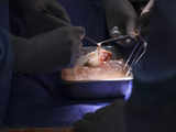 Big news for Kidney patients: Pig kidney successfully transplanted into a living patient