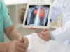 Lung cancer: ICMR invites researchers to conduct meta-analyses for evidence-based guidelines