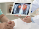 Lung cancer: ICMR invites researchers to conduct meta-analyses for evidence-based guidelines