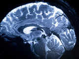 World's most powerful MRI produces unseen images of human brain