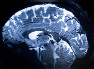 This image made with the Iseult Magneton 11.7 T MRI shows a brain during a magnetic resonance imaging (MRI) exam simulation at the Neurospin facilities in the Paris-Saclay Alternative Energies and Atomic Energy Commission (CEA - Commissariat a l'energie atomique et aux energies alternatives) centre in Gif-sur-Yvette, on March 22, 2024.