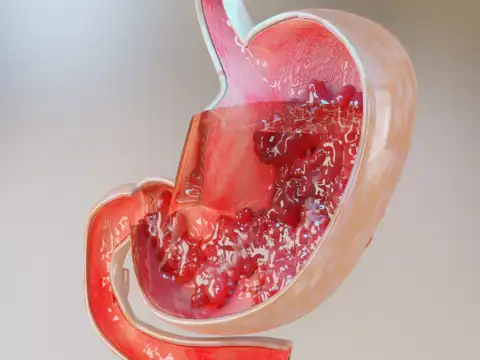 Digestive health
