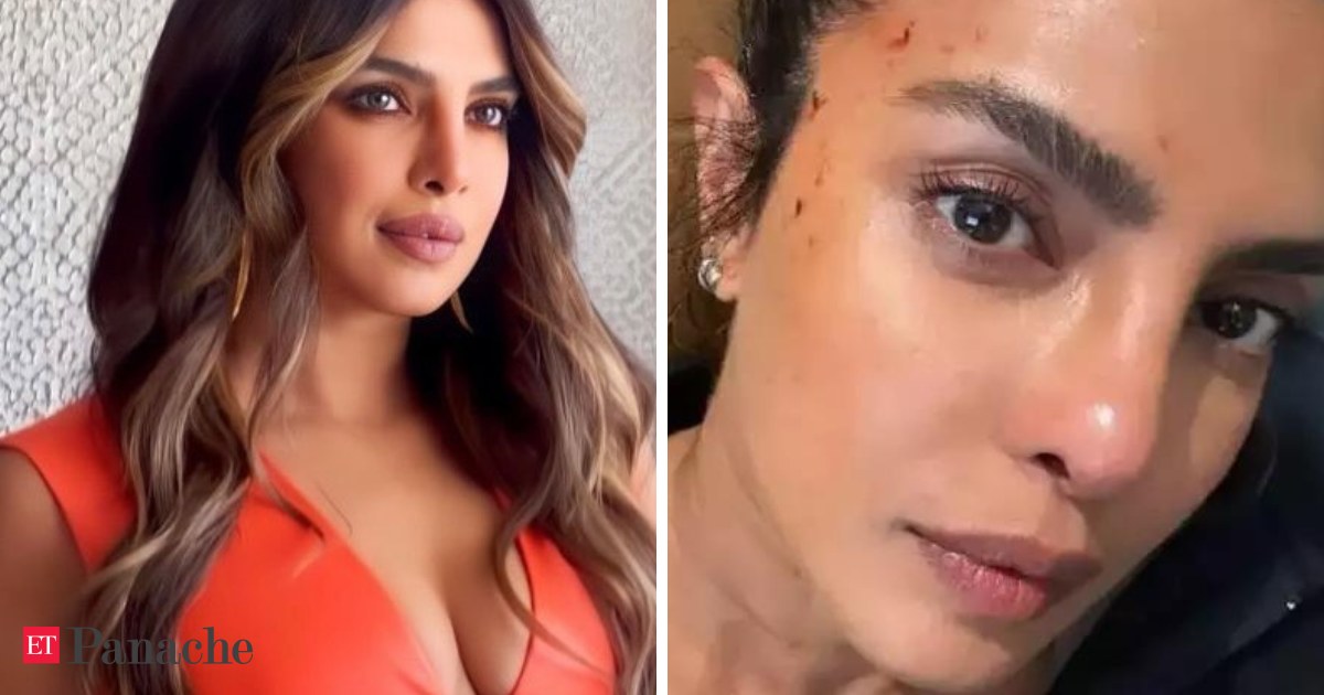 Was Priyanka Chopra's latest stunt too risky? Actress sustains injury on 'Heads Of State' set, shares bloo