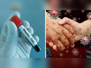 Why has measles returned to UK? Pandemic spreads, children hit hard. Know in detail