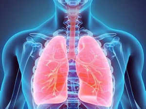'Unusual' form of cell death underlies lung damage in Covid patients, finds study:Image