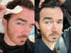 Kevin Jonas undergoes surgery for skin cancer. Latest health update of Jonas Brothers singer