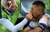 Kylian Mbappe sustained a broken nose at Euro 2024, but France gets 'positive' news