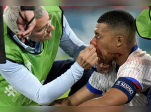 Kylian Mbappé sustained a broken nose at Euro 2024, but France gets 'positive' news