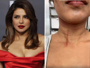 Priyanka Chopra suffers throat injury while shooting Hollywood movie