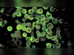 brain-eating amoeba
