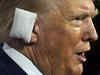 What is the ear reconstruction surgery that Donald Trump may have to undergo?