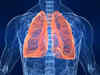 Burden of lung diseases in India likely much higher than Lancet study's projection: Doctors