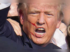 Donald Trump assassination attempt: Where are the stitches? Where are the scars?" Know in detail.