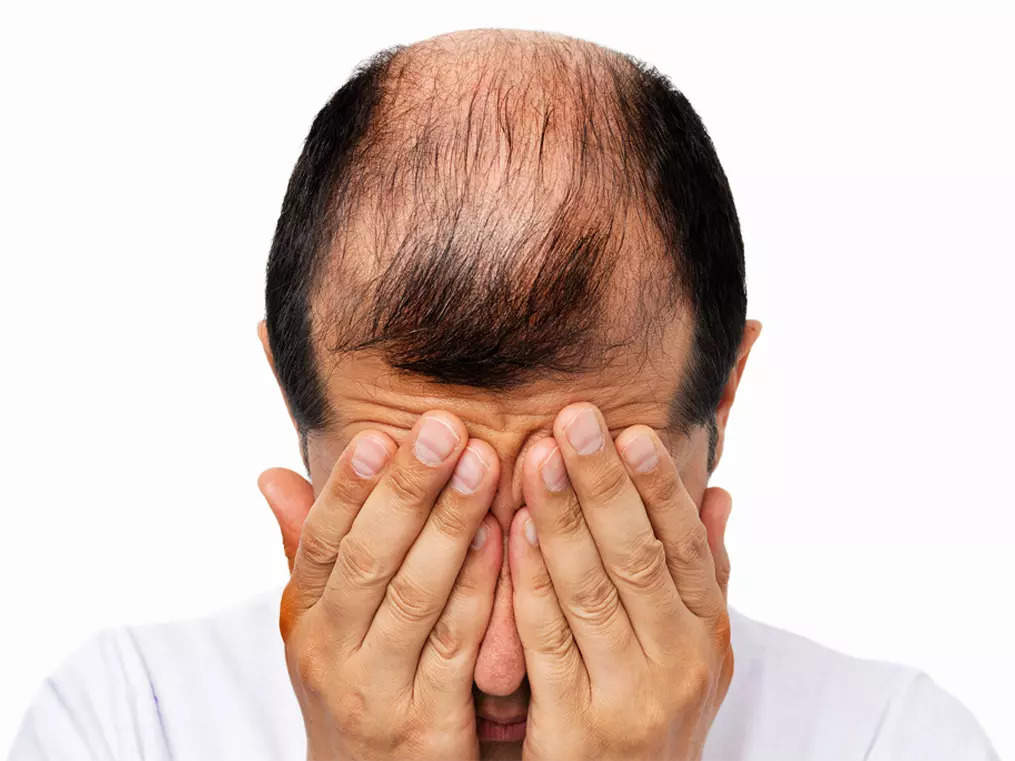 Sun Pharma’s new drug to take on Pfizer, Eli Lilly is having a bad hair day.