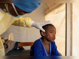 FILE PHOTO: A child suffering from mpox in Democratic Republic of Congo