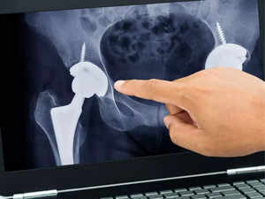 A new lease of life after a complex hip surgery