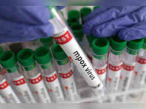 FILE PHOTO: Illustration shows test tubes with "Mpox virus positive" label