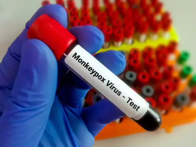 Monkeypox RT-PCR Test: A step-by-step guide for accurate results ...