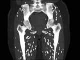 Parasites can infect your brain and body if you are eating this undercooked meat. Doctor shares 'craziest CT scan'