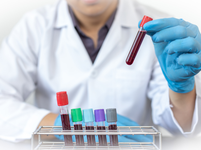 Understanding the AnWj antigen