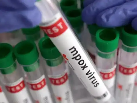 What is Mpox