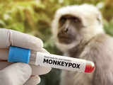 Monkeypox in India: Key do's and don'ts you need to follow