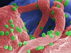 HIV is back; there has been a 30% surge in 2 years; is it that fatal now?