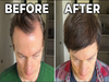 Tech tycoon Bryan Johnson's hair-raising transformation shocks the world: Here's how he reversed hair loss and greying by 70%