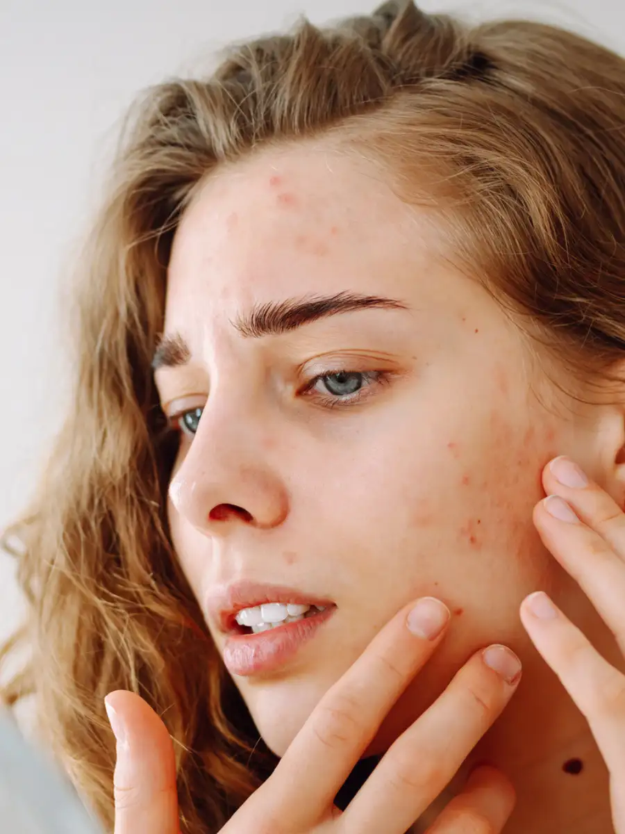 8 effective home remedies to fade skin pigmentation | EconomicTimes