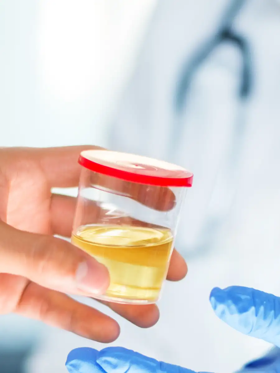 ​8 drinks to keep your uric acid levels balanced​