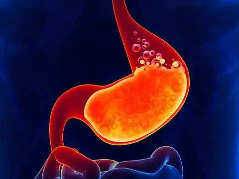 Reduces Acid Reflux