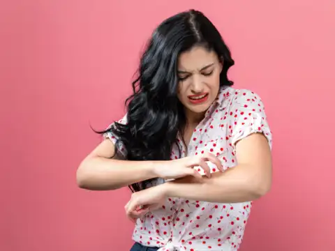 Skin Problems