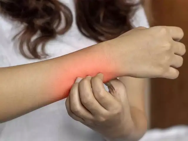 Are these 6 unusual signs pointing to Diabetes in youth? - Dark patches ...