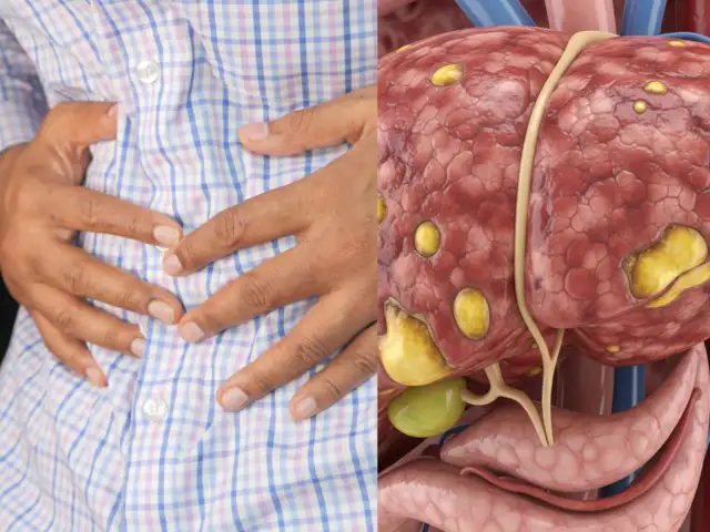 Belly fat, dark patches, and fatigue? Your liver may be begging for help