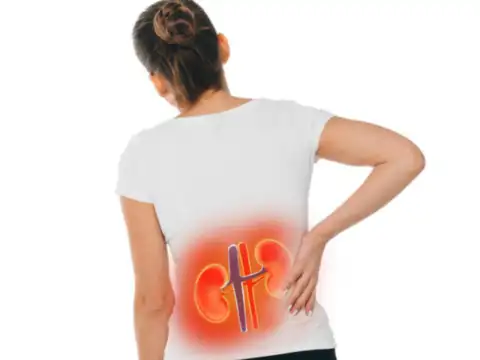 Kidney Strain
