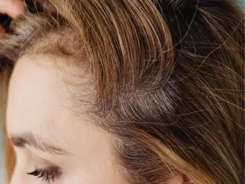 Fine or thinning hair