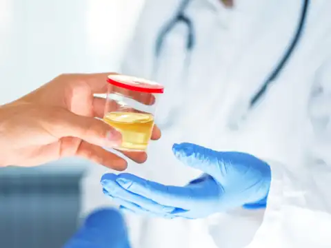 Dark Urine and Pale Stools