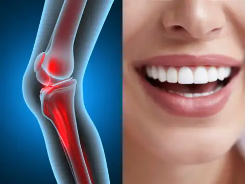 Strengthens bones & teeth