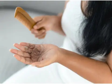  Androgen-related thinning &mdash; what to eat for it