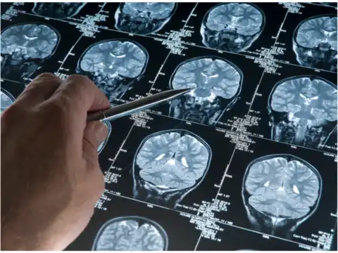 Brain benefits
