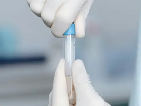 Blood Tests 